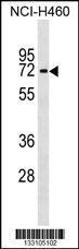 Anti-IFNLR1 Rabbit Polyclonal Antibody (AP (Alkaline Phosphatase))