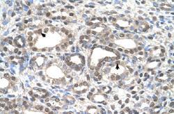 Anti-DFNA5 Rabbit Polyclonal Antibody