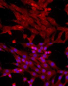 Immunofluorescence analysis of NIH/3T3 cells using Anti-Bcl-2 Antibody (A12540) at a dilution of 1:50 (40x lens). DAPI was used to stain the cell nuclei (blue)