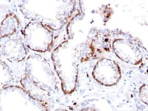 Immunohistochemical analysis of formalin-fixed, paraffin-embedded human prostate using Anti-Cytokeratin 15 Antibody [KRT15/2103R]