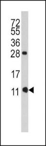 Anti-FKBP1B Rabbit polyclonal antibody