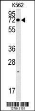 Anti-NPSR1-AS1 Rabbit Polyclonal Antibody (AP (Alkaline Phosphatase))