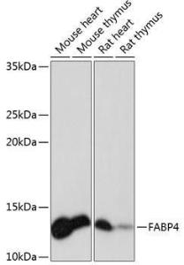 Anti-FABP4 Rabbit Monoclonal Antibody [clone: ARC0616]