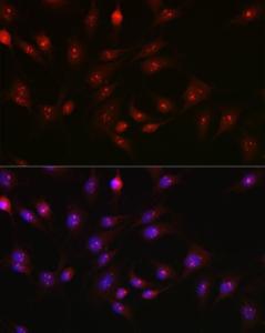 Immunofluorescence analysis of C6 cells using Anti-PARP1 Antibody (A308167) at a dilution of 1:100 (40x lens). DAPI was used to stain the cell nuclei (blue).