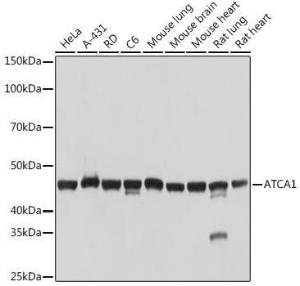 Western blot analysis of extracts of various cell lines, using Anti-muscle Actin Antibody [ARC1913] (A307098) at 1:1,000 dilution. The secondary antibody was Goat Anti-Rabbit IgG H&L Antibody (HRP) at 1:10,000 dilution.