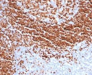 Immunohistochemical analysis of formalin-fixed, paraffin-embedded human tonsil tissue using Anti-SOX11 Antibody [SOX11/7236]