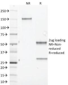 SDS-PAGE analysis of Anti-Aurora B Antibody [AURKB/1845] under non-reduced and reduced conditions; showing intact IgG and intact heavy and light chains, respectively. SDS-PAGE analysis confirms the integrity and purity of the antibody.