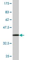 Anti-CRYM Mouse Monoclonal Antibody [clone: 1C6]