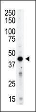 Anti-AURKB Rabbit Polyclonal Antibody (FITC (Fluorescein Isothiocyanate))