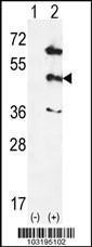 Anti-MAP Kinase 12 Rabbit Polyclonal Antibody (HRP (Horseradish Peroxidase))