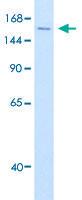 Anti-DHX9 Rabbit Polyclonal Antibody