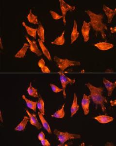 Immunofluorescence analysis of HeLa cells using Anti-muscle Actin Antibody [ARC1913] (A307098) at a dilution of 1:100 (40x lens). DAPI was used to stain the cell nuclei (blue).