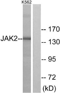 Anti-Jak2 Rabbit Polyclonal Antibody