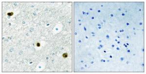 Immunohistochemical analysis of paraffin-embedded human brain tissue using Anti-TPD52 Antibody. The right hand panel represents a negative control, where the antibody was pre-incubated with the immunising peptide.