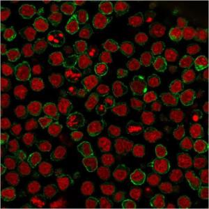 Anti-CD22 antibody