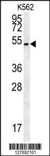 Anti-HHAT Rabbit Polyclonal Antibody