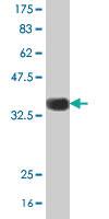 Anti-GNB5 Mouse Polyclonal Antibody