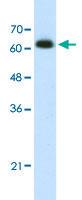 Anti-DIS3L2 Rabbit Polyclonal Antibody