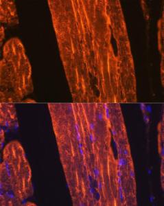 Immunofluorescence analysis of rat skeletal muscle using Anti-muscle Actin Antibody [ARC1913] (A307098) at a dilution of 1:100 (40x lens). DAPI was used to stain the cell nuclei (blue).