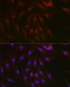 Immunofluorescence analysis of NIH-3T3 cells using Anti-PARP1 Antibody (A308167) at a dilution of 1:100 (40x lens). DAPI was used to stain the cell nuclei (blue).