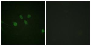 Immunofluorescence analysis of NIH/3T3 cells using Anti-MAD1 Antibody. The right hand panel represents a negative control, where the antibody was pre-incubated with the immunising peptide