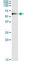 Anti-DEPDC7 Polyclonal Antibody Pair