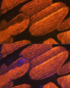 Immunofluorescence analysis of mouse skeletal muscle using Anti-muscle Actin Antibody [ARC1913] (A307098) at a dilution of 1:100 (40x lens). DAPI was used to stain the cell nuclei (blue).