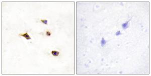 Antibody anti-IP6K3 100 µg