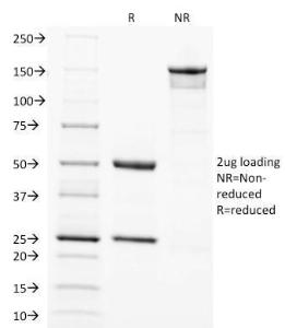 Antibody anti-SOX2 SOX21792 100 µg