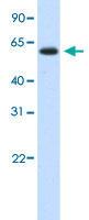 Anti-DIS3L2 Rabbit Polyclonal Antibody