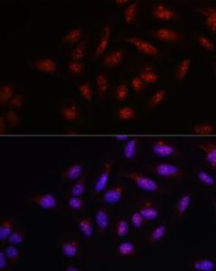 Immunofluorescence analysis of U-2 OS cells using Anti-PARP1 Antibody (A308167) at a dilution of 1:100 (40x lens). DAPI was used to stain the cell nuclei (blue).