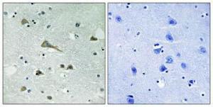 Immunohistochemical analysis of paraffin-embedded human brain using Anti-TIRAP Antibody 1:100 (4°C overnight). The right hand panel represents a negative control, where the antibody was pre-incubated with the immunising peptide.