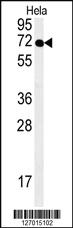 Anti-SPT13 Rabbit Polyclonal Antibody