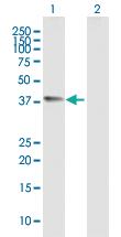 Anti-CHI3L1 Mouse Polyclonal Antibody