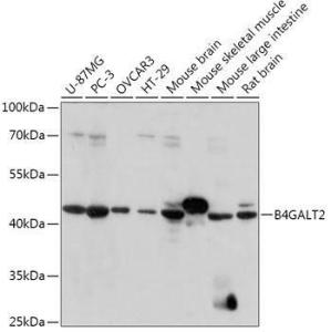 Western blot analysis of extracts of various cell lines, using Anti-B4GALT3 Antibody (A308168) at 1:1000 dilution. The secondary Antibody was Goat Anti-Rabbit IgG H&L Antibody (HRP) at 1:10000 dilution. Lysates/proteins were present at 25 µg per lane