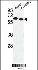 Anti-USP15 Rabbit Polyclonal Antibody