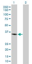 Anti-CHI3L1 Rabbit Polyclonal Antibody