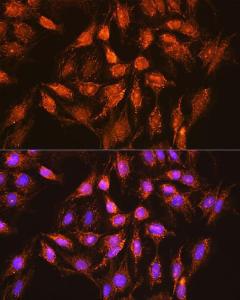 Anti-Bcl-XL antibody