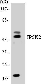 Western blot analysis of the lysates from K562 cells using Anti-IP6K2 Antibody