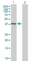 Anti-SSBP2 Mouse Polyclonal Antibody