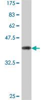 Anti-TPRKB Mouse Polyclonal Antibody