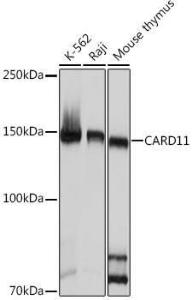 Western blot analysis of extracts of various cell lines, using Anti-Carma 1/CARD11 Antibody [ARC1680] (A305673) at 1:1,000 dilution