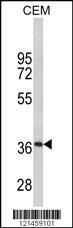 Anti-MPZ Rabbit Polyclonal Antibody