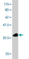 Anti-SRC Mouse Monoclonal Antibody [clone: 1B9]