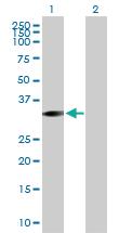 Anti-STK16 Mouse Polyclonal Antibody