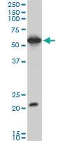 Anti-EBF3 Mouse Monoclonal Antibody [clone: 1G3]