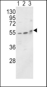 Anti-ALPL Rabbit Polyclonal Antibody