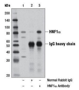 Anti-Hepatocyte Nuclear Factor 1 Alpha Rabbit Polyclonal Antibody