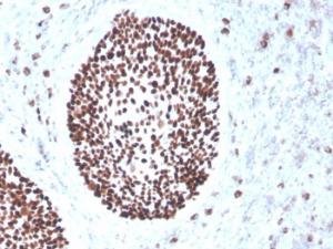 Immunohistochemical analysis of formalin-fixed, paraffin-embedded human cervix using Anti-SOX2 Antibody [rSOX2/1791]