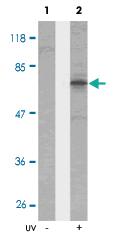 Anti-CHEK2 Rabbit Polyclonal Antibody